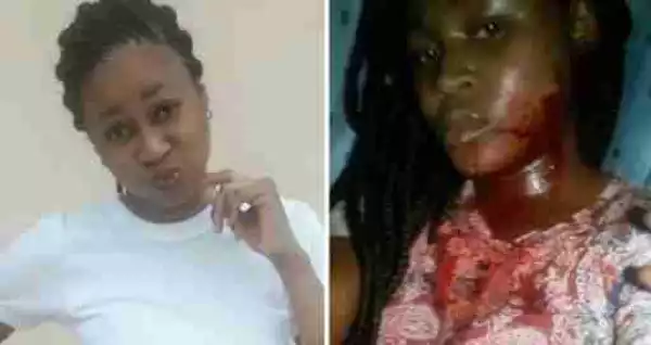 Pretty NOUN Student Stabbed In The Face By Hostel Mate, Lands In Hospital (Graphic)